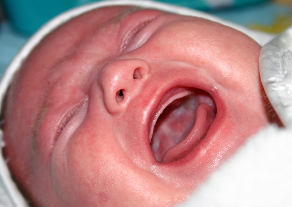 אודיל רוזנפלד במאמר שיעזור לכם להקל על תינוק שסובל מגזים